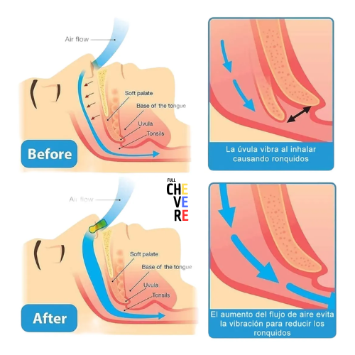 CLIP NASAL ANTIRRONQUIDOS
